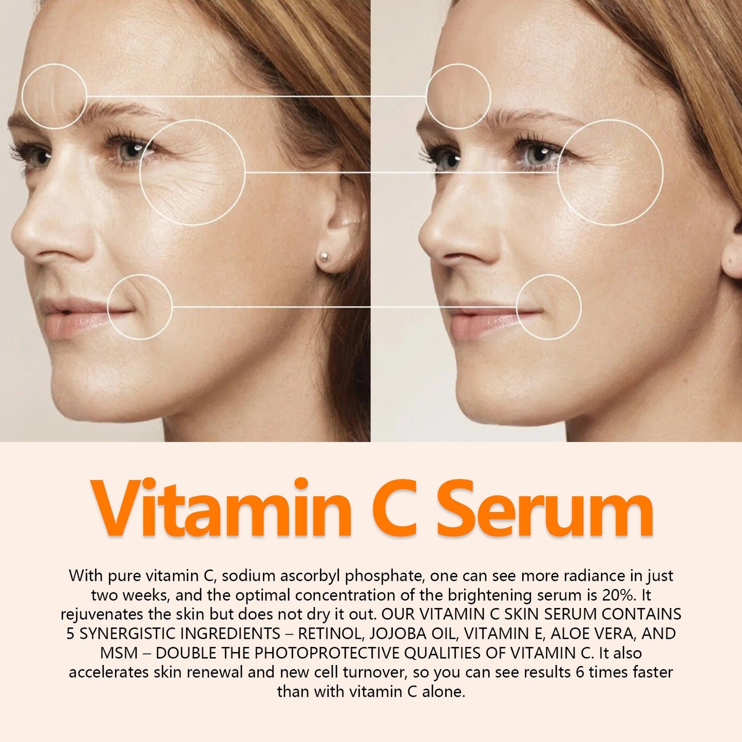 ริ้วรอยเหี่ยวย่นริ้วรอยฝรั่งเศสกระชับผิวหน้า Anti-Aging Care Solution