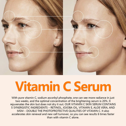 ริ้วรอยเหี่ยวย่นริ้วรอยฝรั่งเศสกระชับผิวหน้า Anti-Aging Care Solution